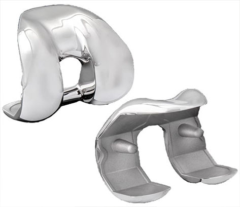 Truliant Primary Knee