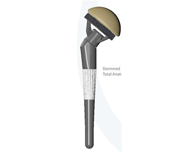 Shoulder Hemiarthroplasty